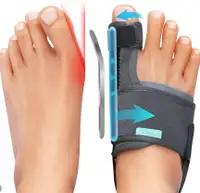 Bunions correction kit for big toe, no pain anymore