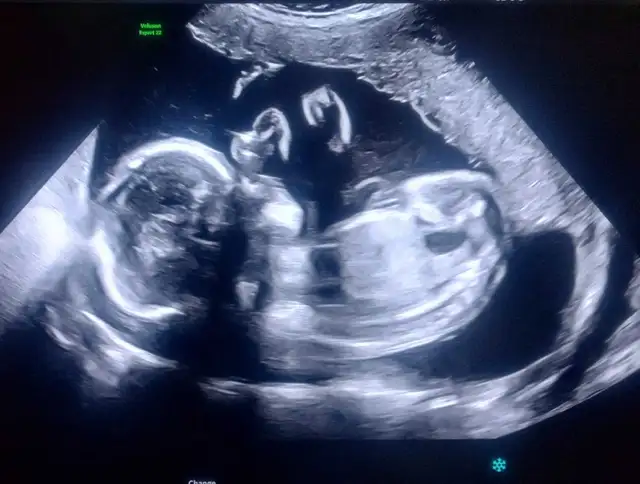 looking for free baby stuff in Other in Ottawa - Image 2