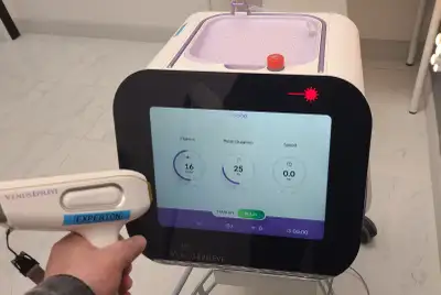 Venus Epileve Portable Diode Laser Hair Removal Machine $17k, View more