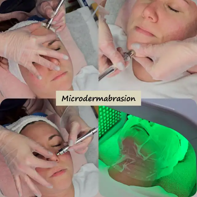 FACE MASSAGE (Sculptural*Plastic*Buccal*Myofascial), FACIAL/PEEL in Health and Beauty Services in City of Toronto - Image 4
