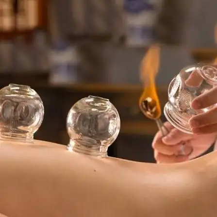 Cupping therapy @home64562374940673121