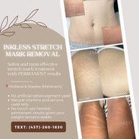 Inkless Stretch Mark Removal