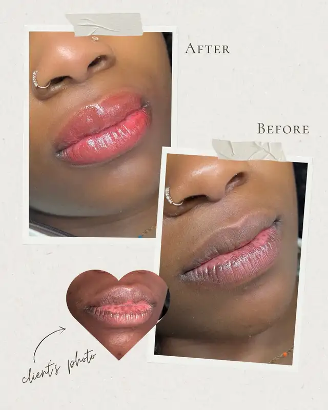Lip blush Neutralization 