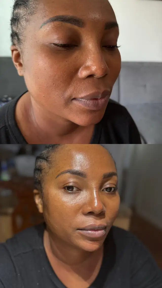 Botox filler - PRP - fat dissolving - skin booster63234910750977121
