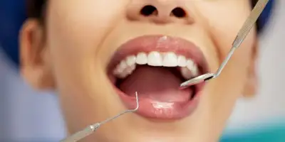 Affordable Dental Cleaning, View more