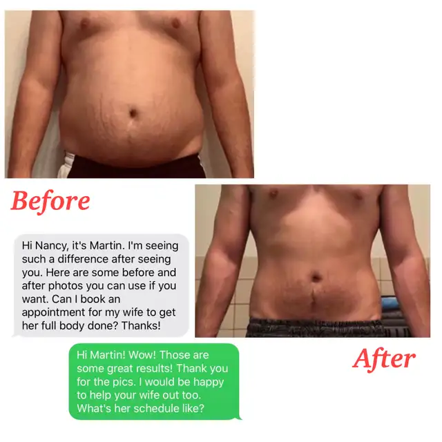 Bodysculpting - Freeze Fat 1/2PRICE - FULL BODY SALE -AFTERPAY62863711841922122