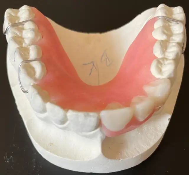 Mobile Denture Service – Smile with Comfort at Home!64684036984579120