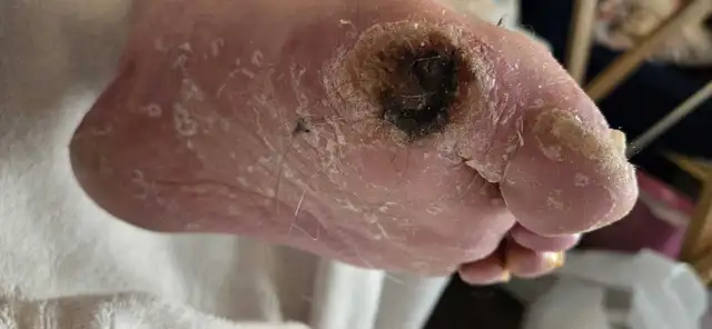 Mobile Advanced Footcare64985458817409124