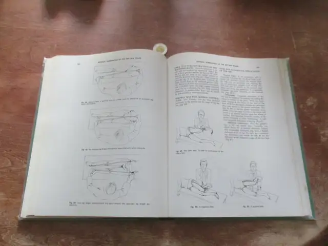 Physical Examination of the Spine and Extremities - 1976 vintage in Textbooks in Québec City - Image 5