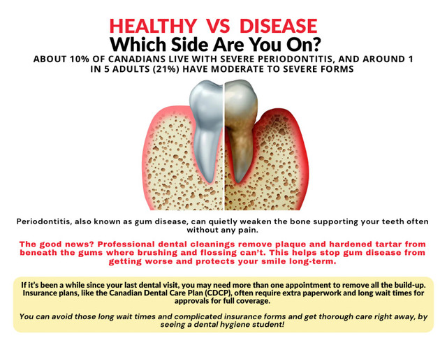 Free Dental Hygiene Care – Plus Bonus Incentives!  in Free Stuff in Mississauga / Peel Region