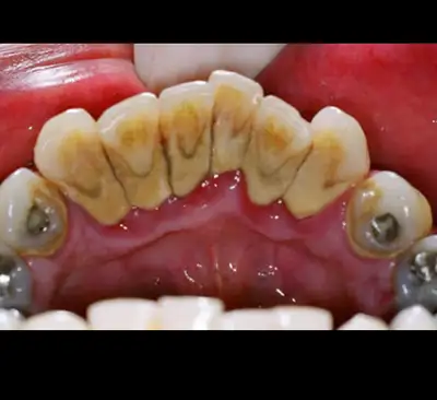 FREE CLEANING (will compensate), View more