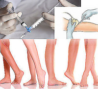 SCLEROTHERAPY,  PRP- SKILLS AND SAFETY CERTIFICATE PROGRAMS