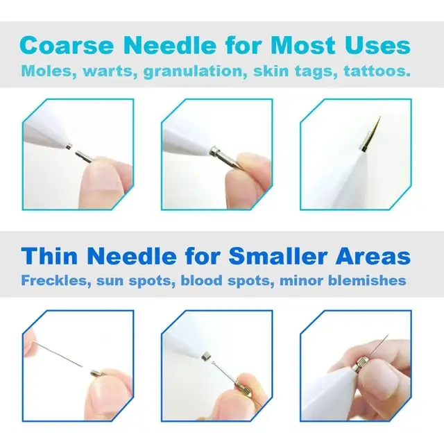 Electronic Skin Tag Remover, Skin Tags Removal Pen in Other in City of Montréal - Image 5