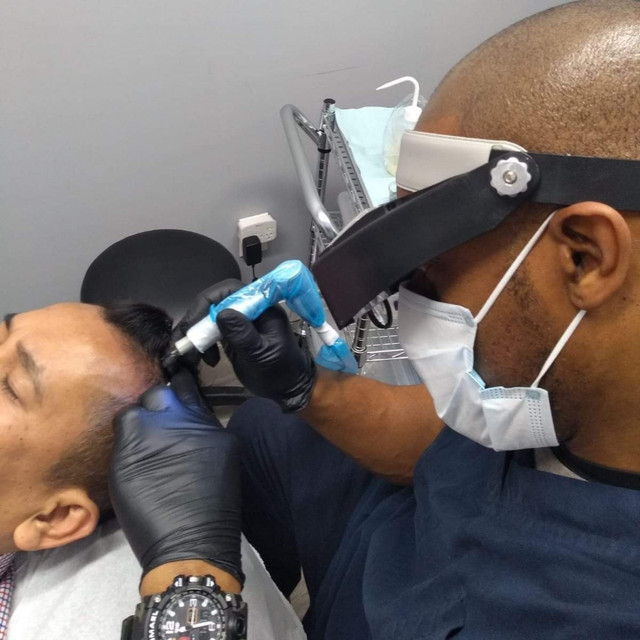 ⭐ Scalp Micropigmentation - Design & Treatment - Call Today ⭐ in Health and Beauty Services in Oshawa / Durham Region - Image 2