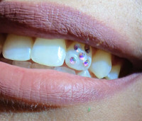 Swarovski tooth Crystals ***$45 SPECIAL ***