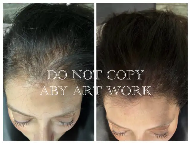 Thin Hair? Crown Issues? I Fix That-Mobile service.64551238985475121