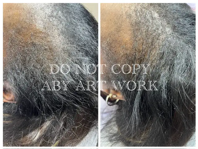 Thin Hair? Crown Issues? I Fix That-Mobile service.64551238985475123