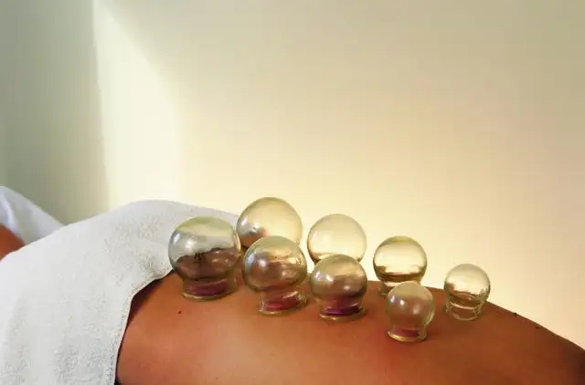 Cupping therapy @home64562374940673123