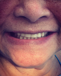  Denture  clinic at sheppard Yonge