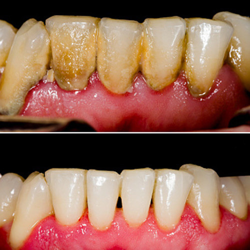 DENTAL CLEANINGS in Auto Body Parts in Mississauga / Peel Region - Image 2