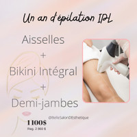 Épilation avec IPL 