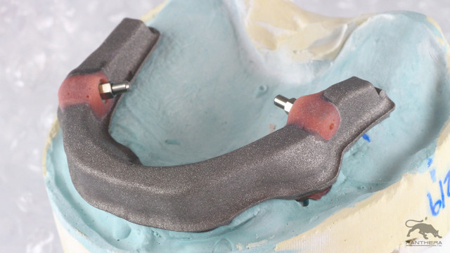 Stony Plain Denture & Implant Clinic - St. Albert in Health and Beauty Services in St. Albert - Image 2