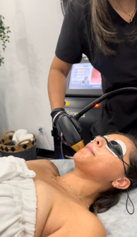 Only $100 FULL BODY Laser hair removal 