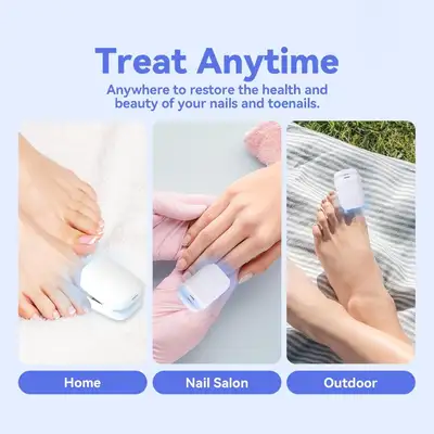 NEW✨ SAVILAND LASER NAIL FUNGUS TREATMENT DEVICE $10  ❤️, View more