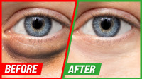 Under Eye Dark Circles/Puffiness/Wrinkles Natural Solutions!!