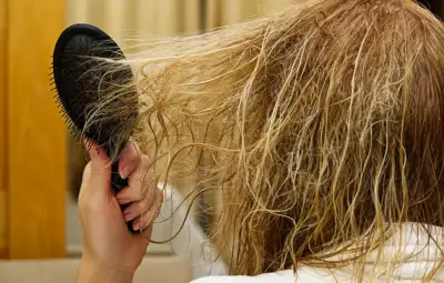 Free Hair Dematting, View more