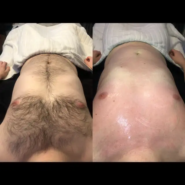 Manzilian Waxing for Men | Experienced & Welcoming Esthetician in Health and Beauty Services in Ottawa - Image 6