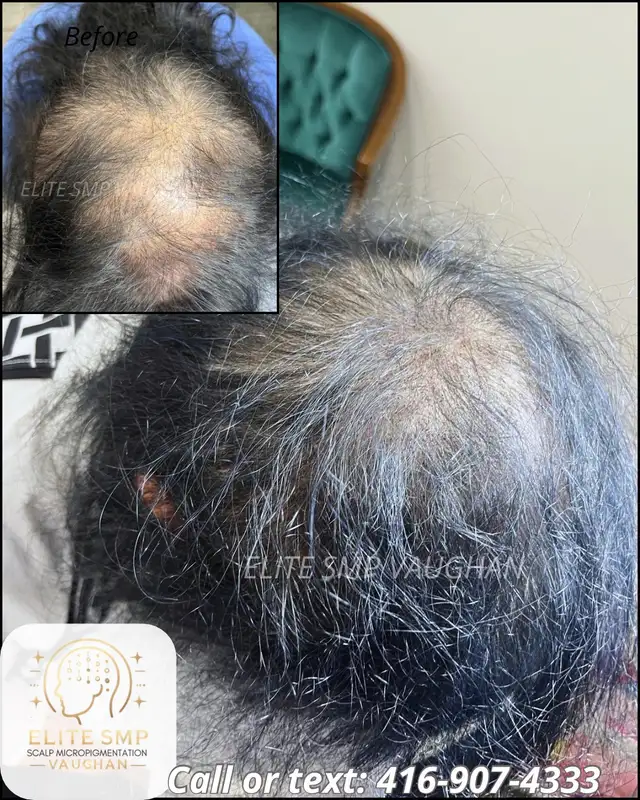 BETTER  THAN HAIR TRANSPLANT63436968683139124