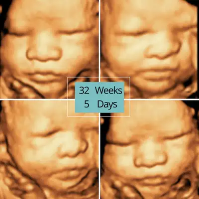 Launch Your Own Business – Affordable & Turnkey! ✅ Complete Ultrasound Equipment Package – Delivered...