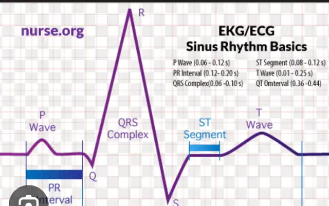 EMR/ PCP/ ECG TUTOR634176187439391226