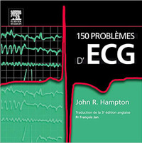 150 problèmes d'ECG, 3e édition par John R. Hampton