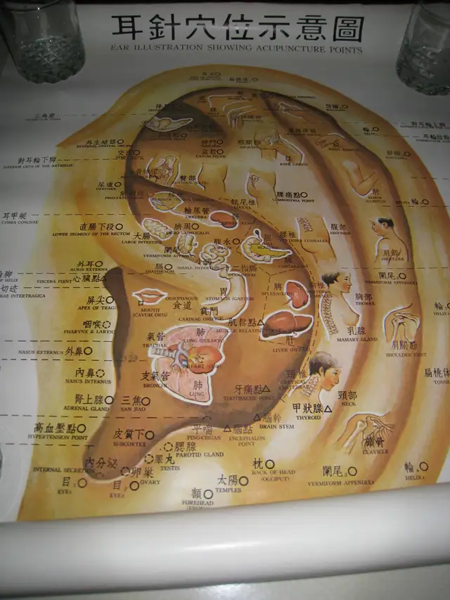 Acupuncture Posters, Books, Notes, Needles in Textbooks in Vancouver - Image 3