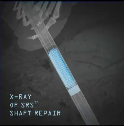 Hockey Stick Shaft Repair, View more
