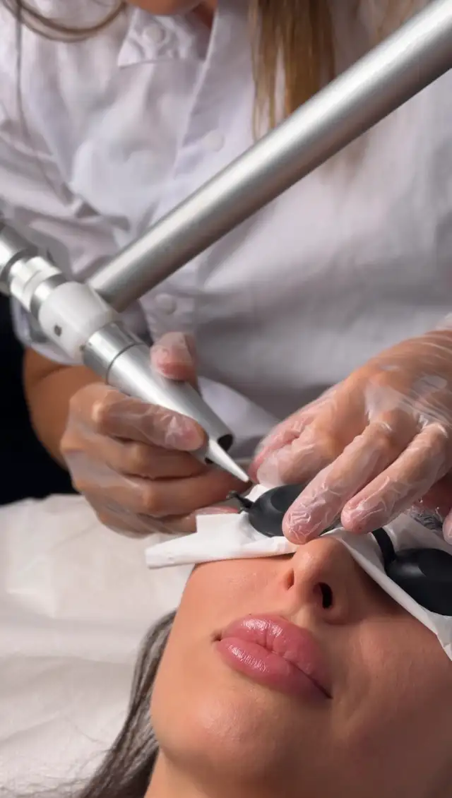 Laser tattoo removal632349613838111223
