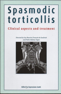 Spasmodic Torticollis Clinical Aspects And Treatment