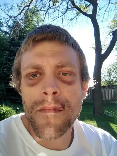 Legal Fee FLIPPER, View more