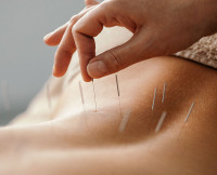 Acupuncturist wanted