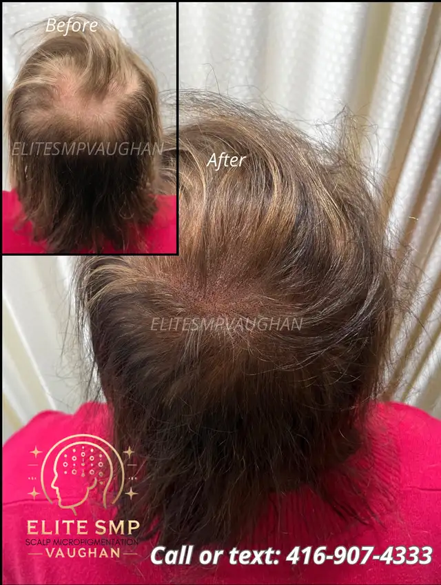 BETTER  THAN HAIR TRANSPLANT63436968683139123