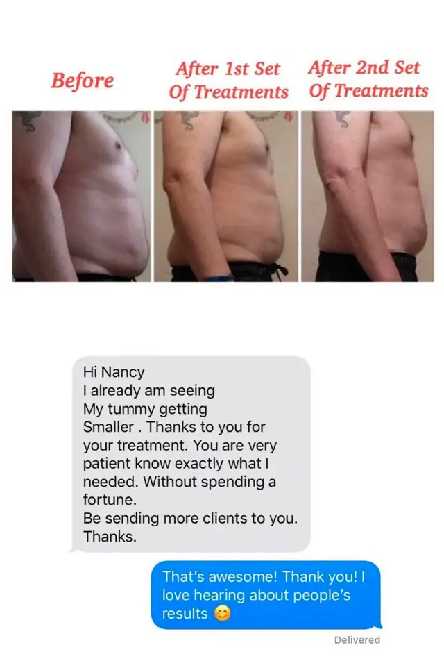 Bodysculpting - Freeze Fat 1/2PRICE - FULL BODY SALE -AFTERPAY62863711841922124