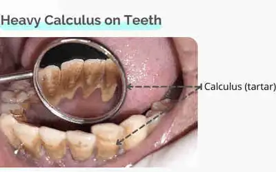 GET PAID TO HAVE YOUR TEETH CLEANED BY STUDENT!, View more