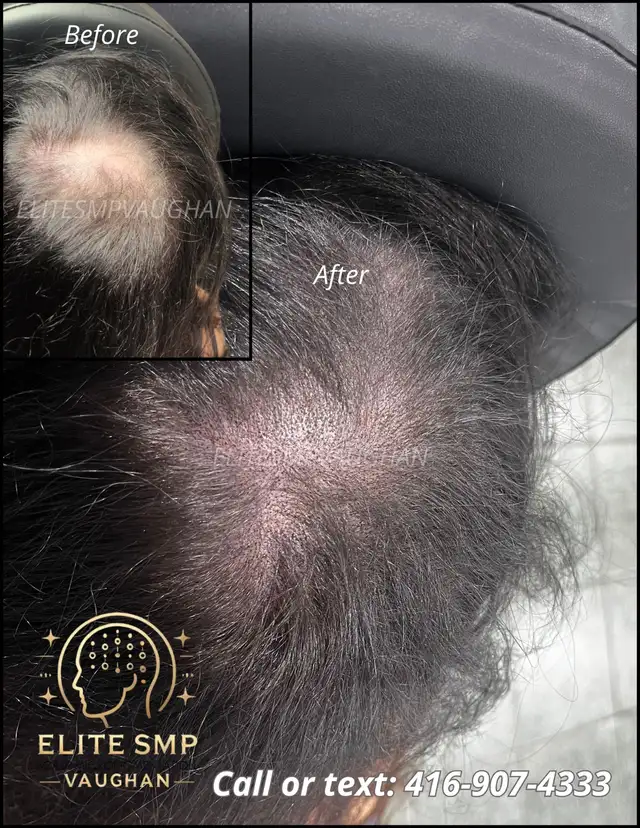 BETTER  THAN HAIR TRANSPLANT63436968683139122