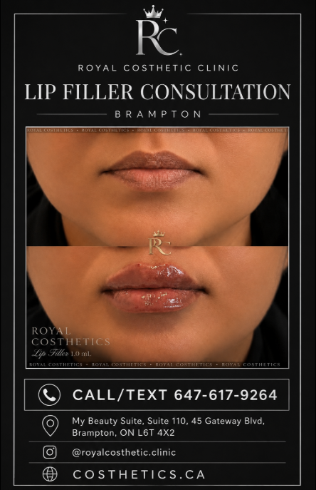 FREE ** LIP FILLER CONSULTATION