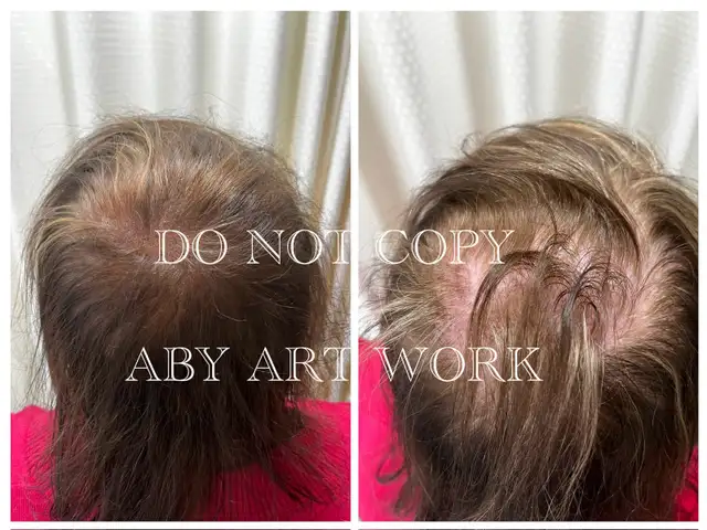 Thin Hair? Crown Issues? I Fix That-Mobile service.64551238985475124
