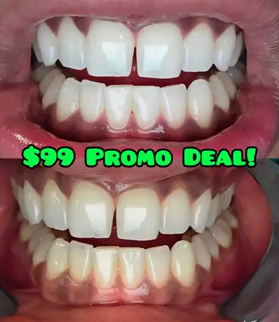 ✨ Want a brighter smile? At Passion Tooth, your teeth whitening is performed by a Registered Dental...