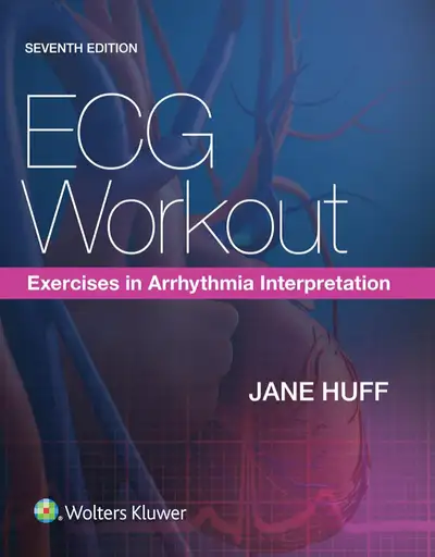 ECG Workout: Exercises in Arrhythmia Interpretation, View more