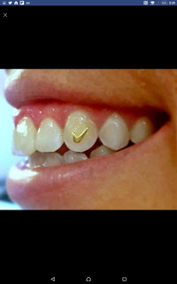 Gold Tooth Jewelry (22K or 18K)